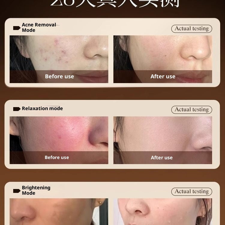 LED Light Therapy Face Mask – Red, Blue & Yellow Phototherapy for Acne & Skin Repair